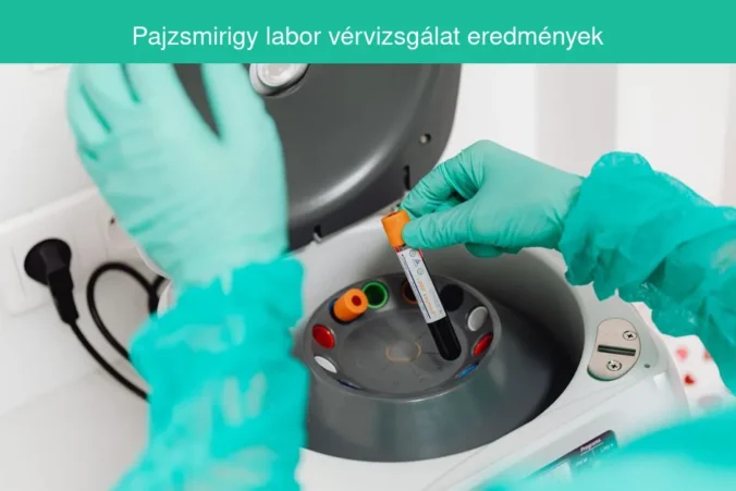 pajzsmirigy labor vérvizsgálat eredmények