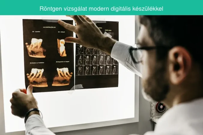 Röntgen vizsgálat modern digitális készülékkel