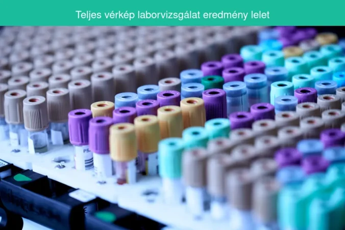 teljes vérkép laborvizsgálat eredmény lelet