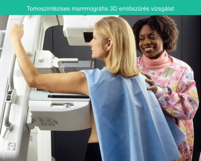 Tomoszintézises mammográfia 3D emlőszűrés vizsgálat