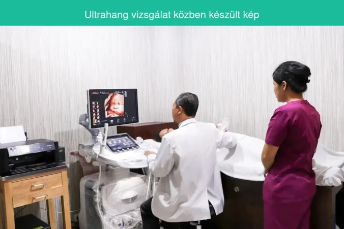 Ultrahang vizsgálat közben készült kép