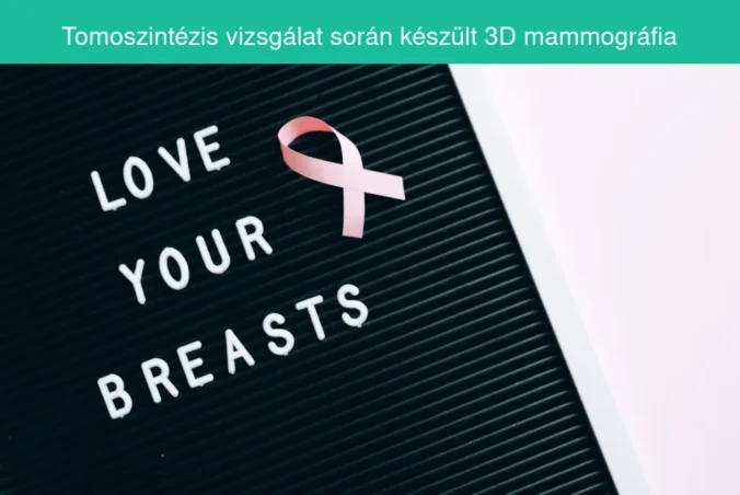 Tomoszintézis vizsgálat során készült 3D mammográfia